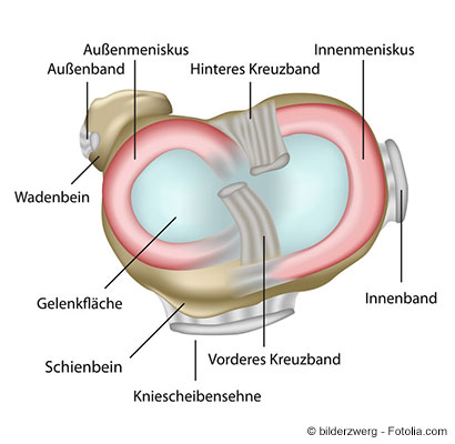 Schematischer Schnitt des Knies mit Meniskus und Kreuzbändern